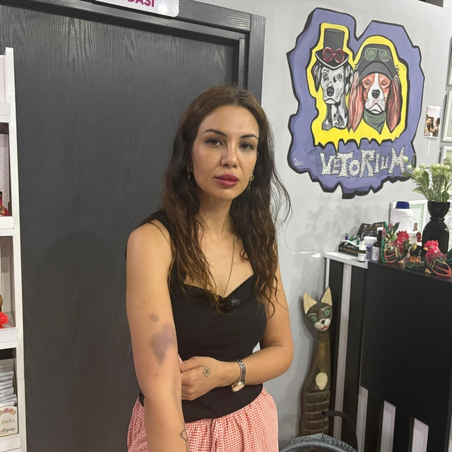 Adana'da komşuları tarafından darbedildiğini öne süren veteriner şikayetçi...