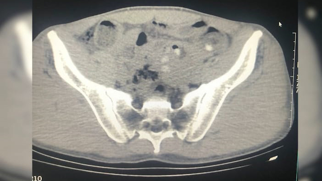 Midelerinde uyuşturucu ile yakalanan yabancı uyruklu 3 şüpheli tutuklandı