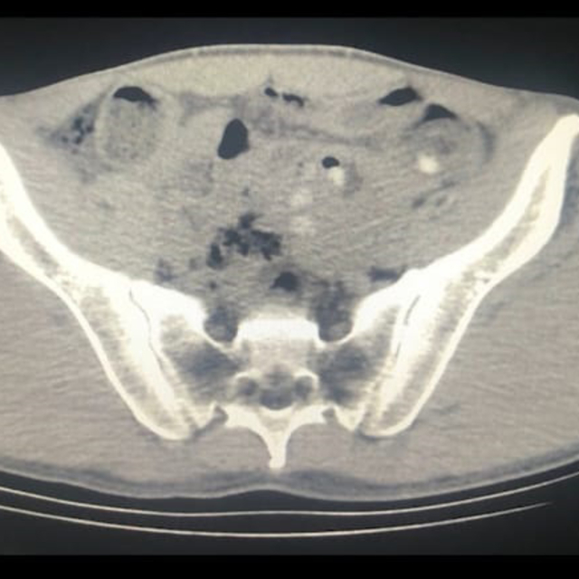 Midelerinde uyuşturucu ile yakalanan yabancı uyruklu 3 şüpheli tutuklandı