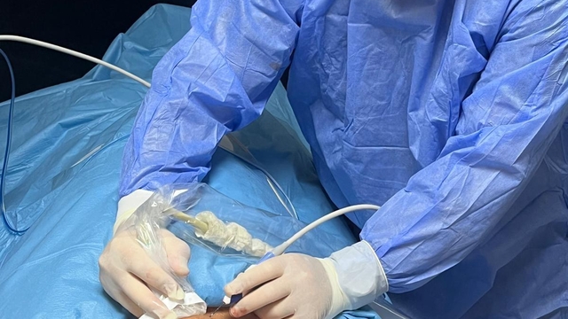 Kütahya'da devasa büyüklükteki guatr ameliyatsız tedavi edildi