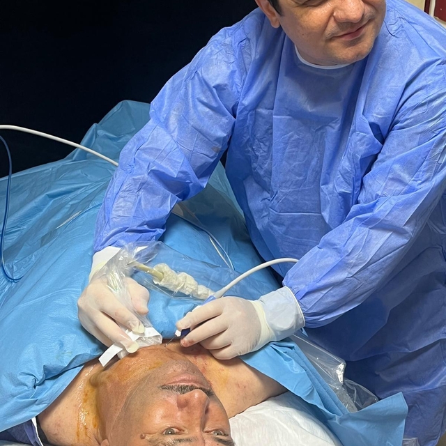 Kütahya'da devasa büyüklükteki guatr ameliyatsız tedavi edildi