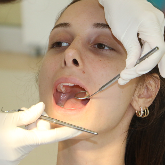 Prof. Dr. Gündüz: 2 haftadan uzun süren ağız yaraları için diş hekimine baş...