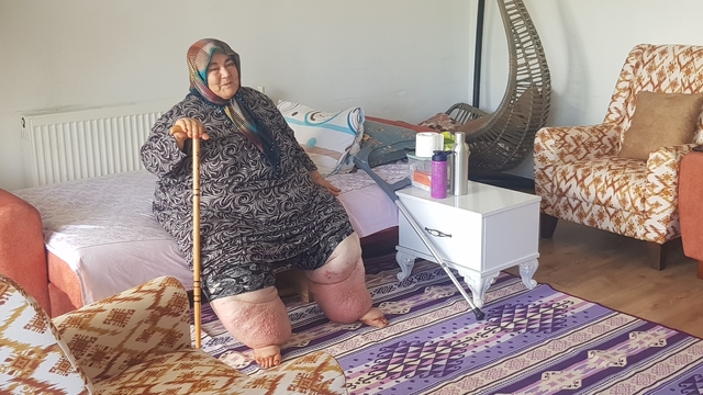 Osmaniye'de yaşayan 160 kilogram ağırlığındaki "fil hastası" Güler'e tekerlekli sandalye desteği