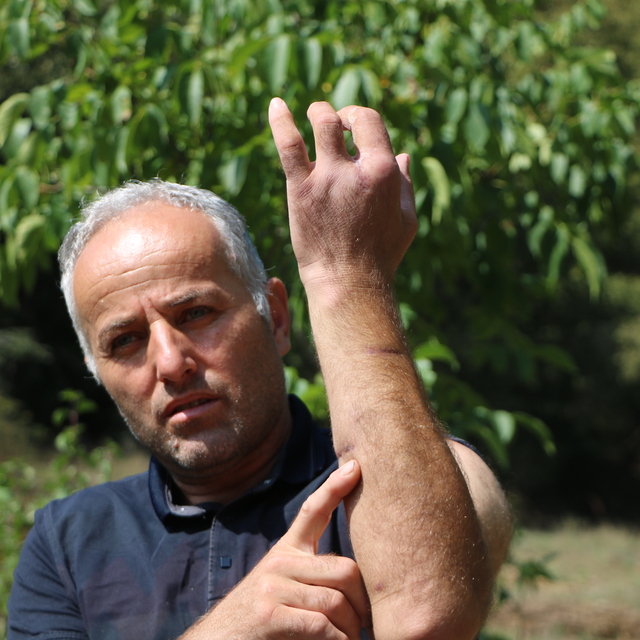 Babası gibi ayı saldırısına uğradı; parmağı koptu