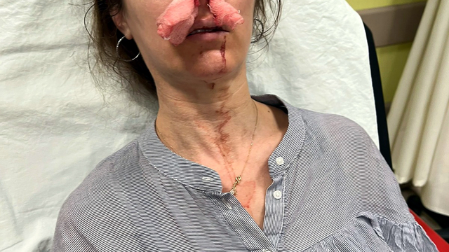 Eşinin sevgilisi sandığı kadını darbettiği 'otomobil kapısı', 'silah' sayıldı