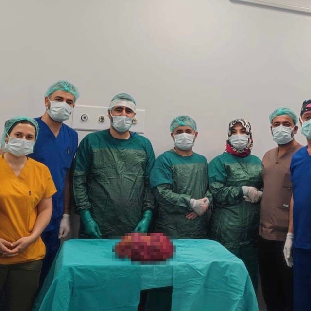 Nefes almasını zorlaştıran 6 kiloluk böbrek ameliyatla çıkarıldı: Kuş gibi...