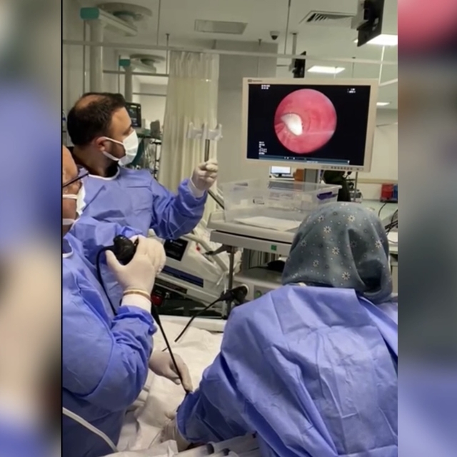 Hastanın akciğerine kaçan sarımsak operasyonla çıkarıldı