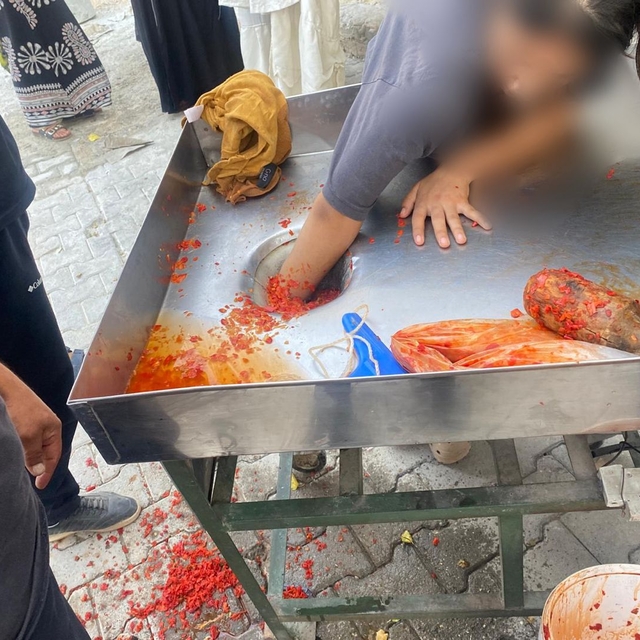 Şanlıurfa'da salça makinesine elini kaptıran genç kız ameliyatla kurtarıldı