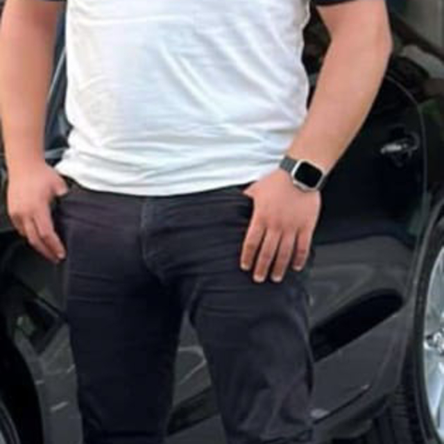 Kazadan 35 gün sonra öldü