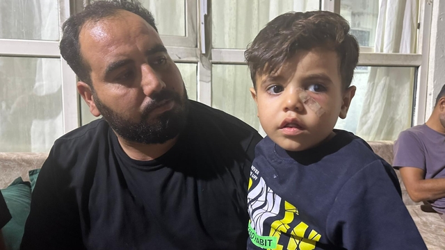 Yorgun mermi, 4 yaşındaki çocuğun gözünün altına isabet etti