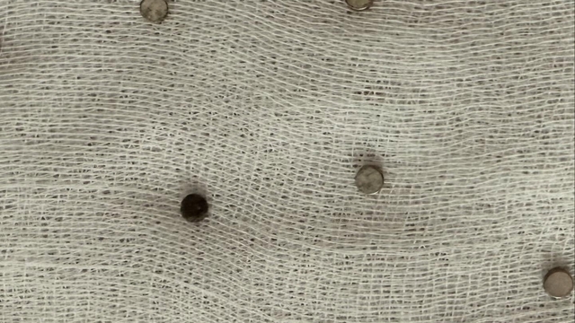 3 yaşındaki çocuğun yuttuğu 19 mıknatıs endoskopiyle çıkarıldı