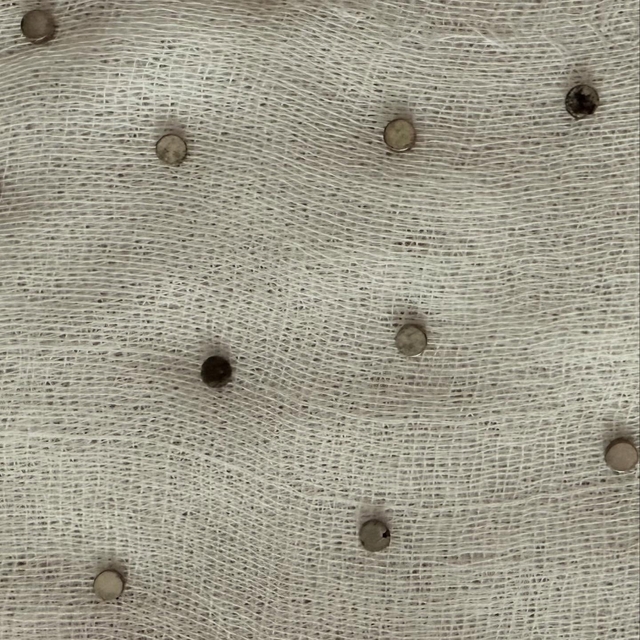 3 yaşındaki çocuğun yuttuğu 19 mıknatıs endoskopiyle çıkarıldı