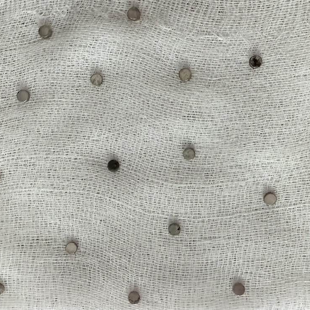 Elazığ'da 3 yaşındaki çocuğun yemek borusundan 19 mıknatıs çıkarıldı