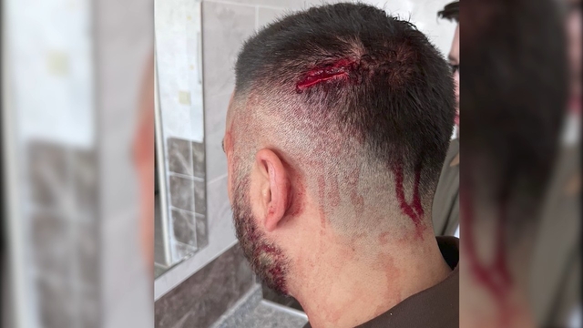 Öğretmene okulda demir sopalı saldırı