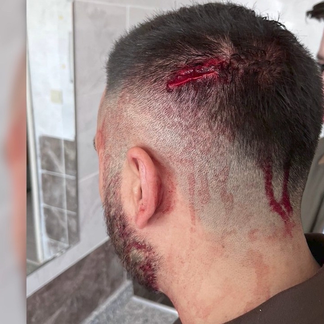 Öğretmene okulda demir sopalı saldırı