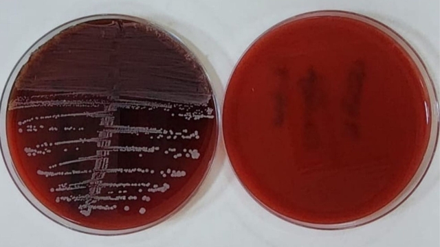Karabük Üniversitesinden implant enfeksiyonlarına karşı yenilikçi yöntem