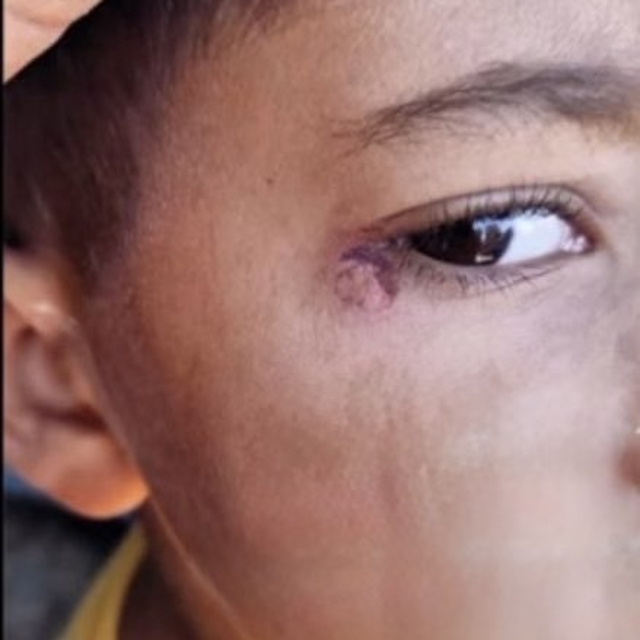 Öğrencinin yüzünde sigara söndüren temizlikçi tutuklandı