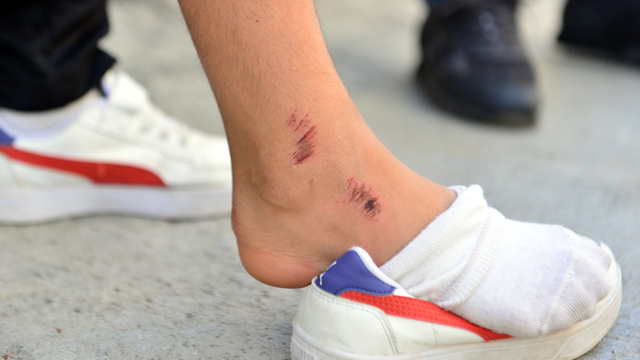 Kovaladığı çocuğu ayak bileğinden tutup yere fırlatan şüpheli tutuklandı (2)