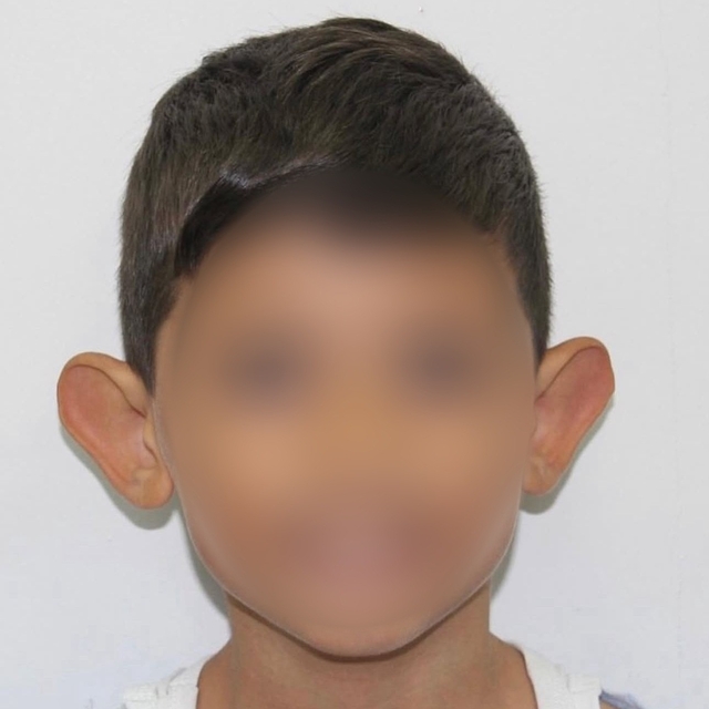 'Kepçe kulak' sorunu çocuklarda özgüveni zedeliyor
Prof. Dr. Hayati Akbaş:...