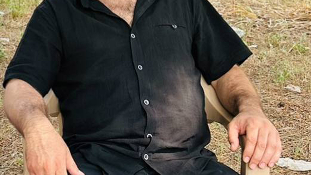 Oto tamirhanesindeki silahlı kavgada yaralandı, 20 gün sonra yaşamını yitirdi