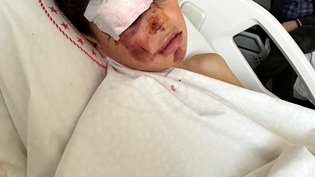 Otomobiliyle 12 yaşındaki bisikletliye çarpıp kaçtı, o anlar kamerada