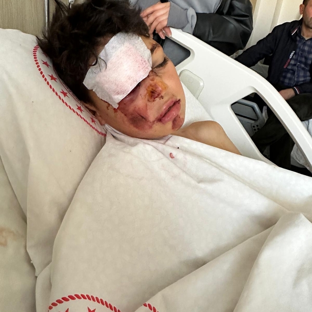 Otomobiliyle 12 yaşındaki bisikletliye çarpıp kaçtı, o anlar kamerada