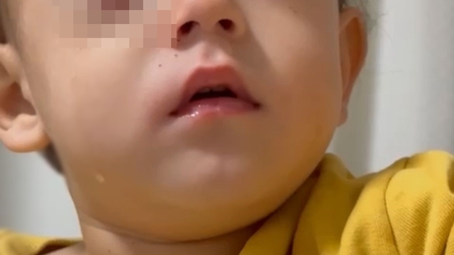 Bursa'da, 2 yaşındaki Alpaslan'ın görme yetisini kaybetmesine neden olan torpil, fırından alınmış