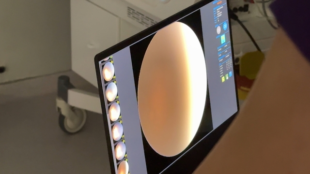 Rize'de 'prematüre retinopatisi' tanı ve tedavisi yapılabilecek