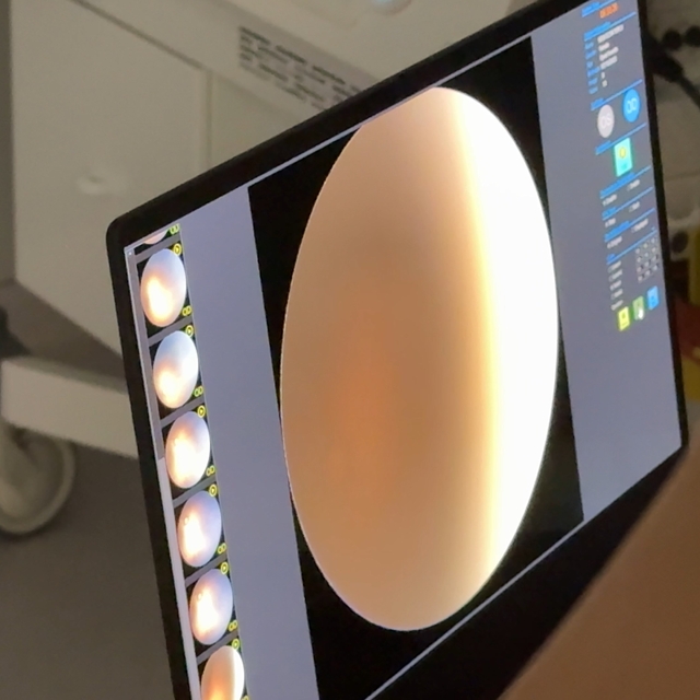 Rize'de 'prematüre retinopatisi' tanı ve tedavisi yapılabilecek