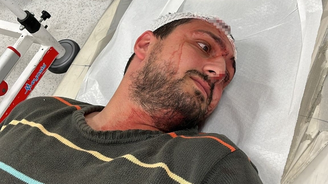 Vicdanları yaralayan olay: Otizmli şahıs odunluğa baktı diye odunla darbedildi
"Savunmasız bir otizmli yetişkine odunla 12-13 kez vurmak ne demek? Vicdanı olan insan böyle bir şey yapmaz"