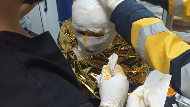 Erzincan'da kömür ocağında yangın: 2 işçi yaralı