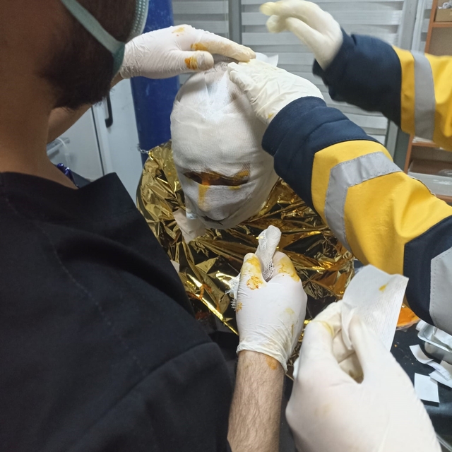 Erzincan'da kömür ocağında yangın: 2 işçi yaralı