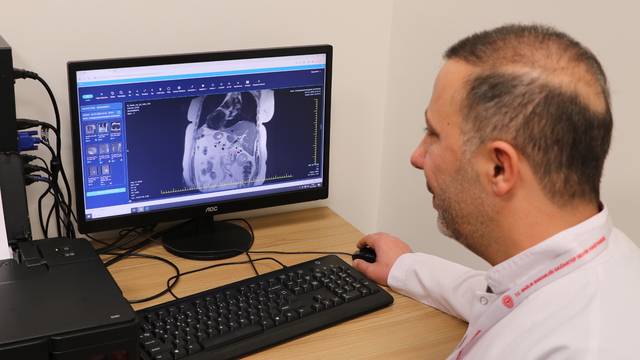 İç organları ters olan hastanın safra kesesindeki taş ERCP işlemiyle alındı