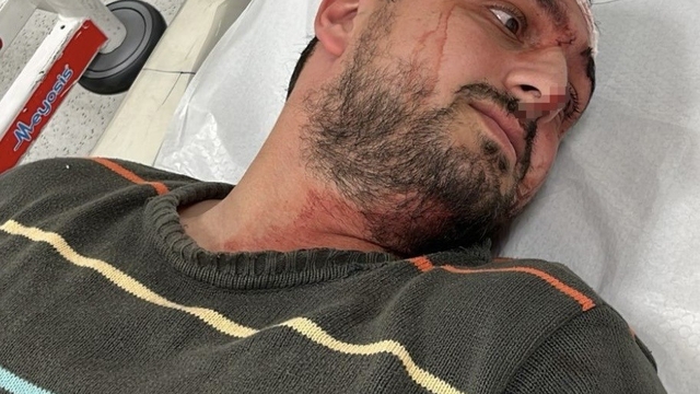 Otizmli genci "odunluğa baktı" diye darbeden fırın çalışanı tutuklandı