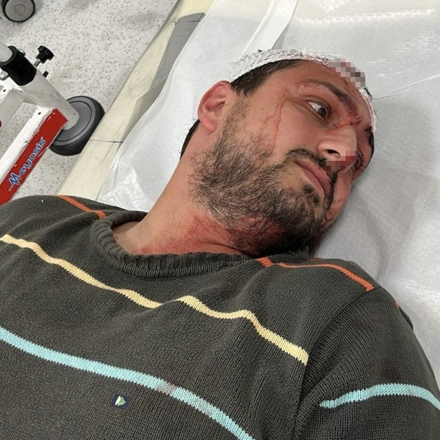 Otizmli genci "odunluğa baktı" diye darbeden fırın çalışanı tutuklandı