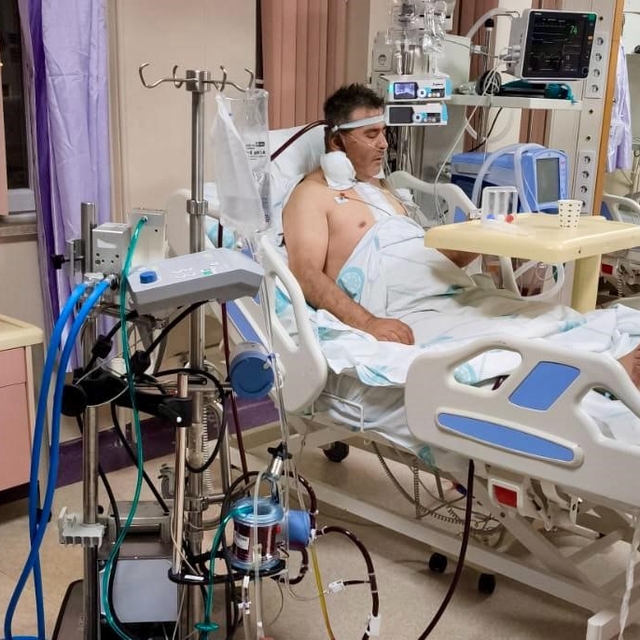 Kalp ameliyatında ECMO başarısı, bir ilk oldu