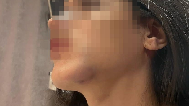 Eski sevgilisi tarafından darbedildiğini iddia edip, fotoğraflarını sosyal medyada paylaştı