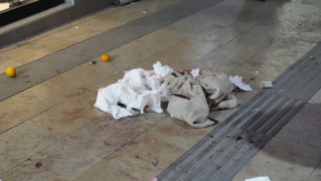 Gümüşhane'de boşanma aşamasındaki eşi tarafından bıçaklanan kadın yaralandı