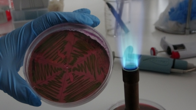 Çiğ süt, gıdayla bulaşan idrar yolu enfeksiyonlarına kapı açıyor