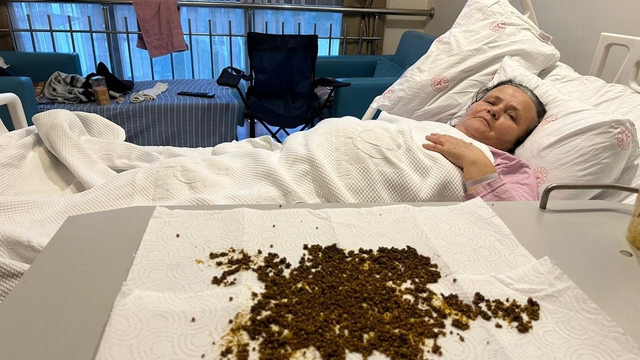 Hastadan çıkan taşları sayamadılar
Manisa'da safra kesesinden ameliyat olan bir kadından 20 binin üzerinde taş çıkarıldı
Hastanın safra kesesinden çıkan taş sayısı, sağlık ekibini bile hayrete düşürdü