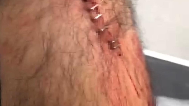 Şanlıurfa'da görev yapan öğretmene sokak ortasında jiletli saldırı