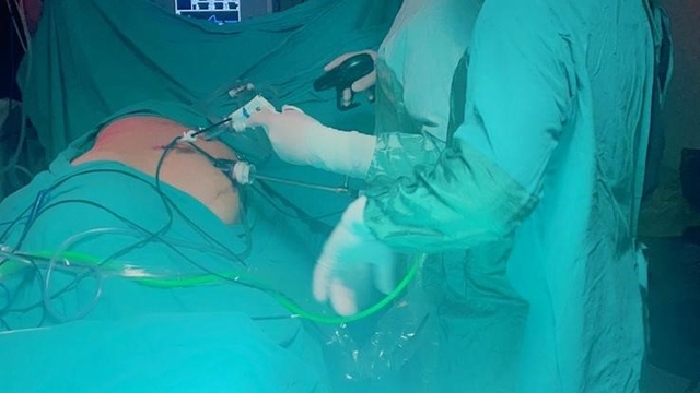 Sivas Devlet Hastanesi doktorlarından büyük başarı