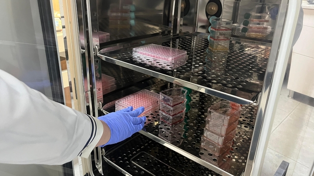 Parkinson'da bağırsak- beyin iletişimi çip üstü organ teknolojisiyle araştırılıyor