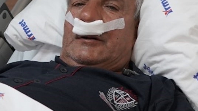 65 yaşındaki adamın burnundan 100 gramlık taş çıkarıldı