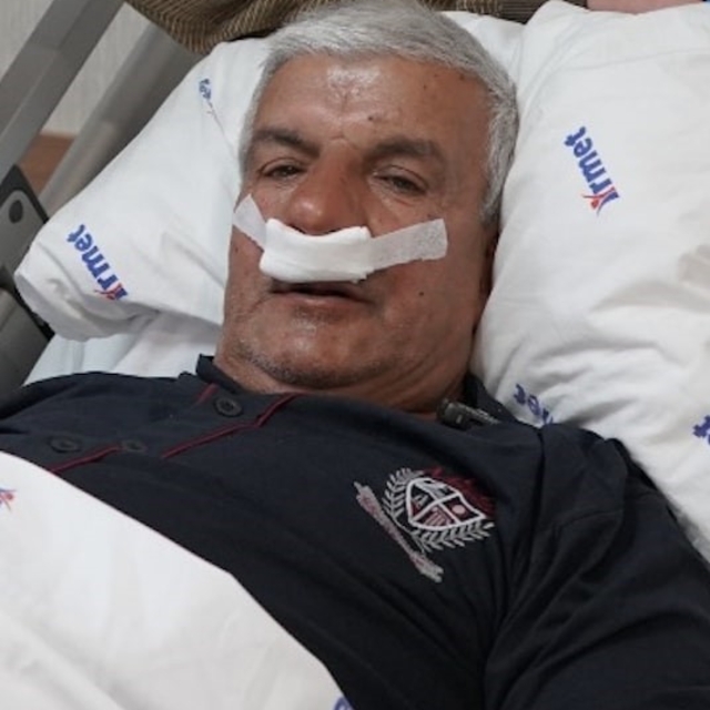 65 yaşındaki adamın burnundan 100 gramlık taş çıkarıldı