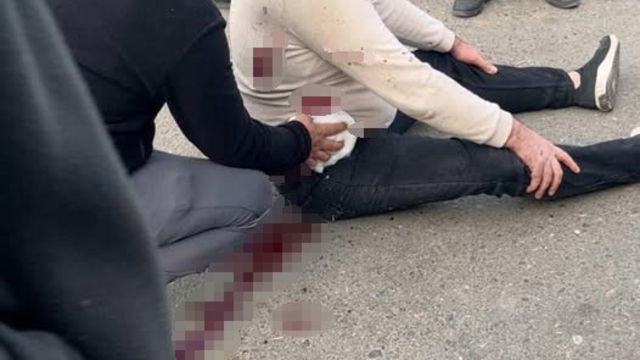 Şanlıurfa'da bıçaklı kavga: 1 yaralı