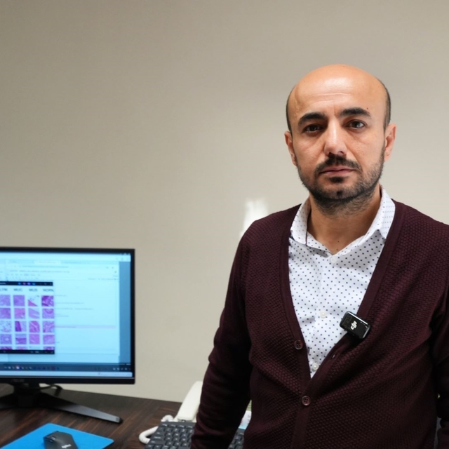 KBÜ'den kolorektal kanserin erken tanısına yapay zekâ desteği