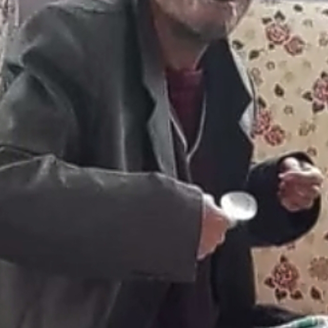 Ölü bulunan zihinsel engellinin vücudunda darp izi (2)