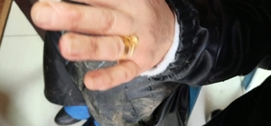 Diyarbakır'da başıboş sokak köpeği dehşeti