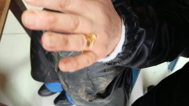 Diyarbakır'da başıboş sokak köpeği dehşeti